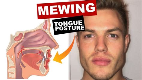 <b>Mewing</b> is actually very simple. . Mewing back of tongue